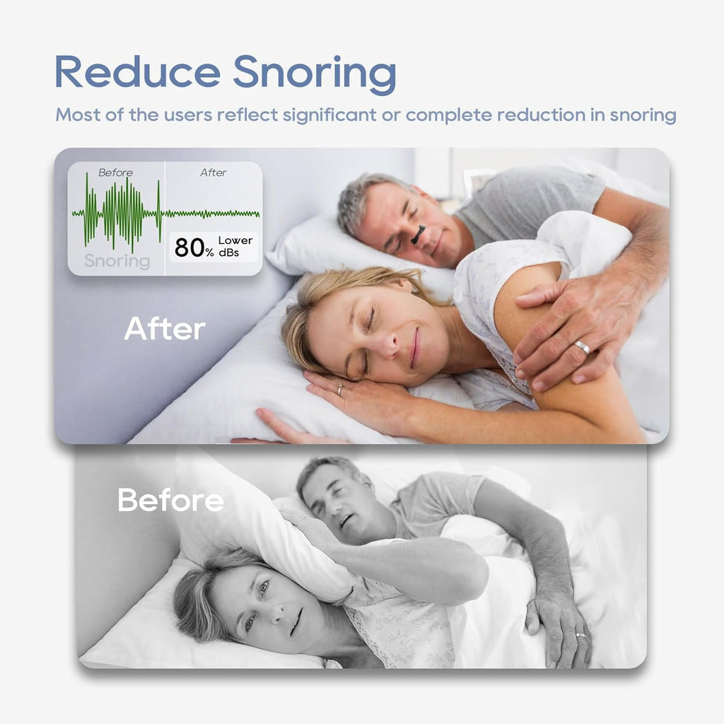 Nasal Breathing Dilators Starter Kits,Anti-snoring Nasal Strips,Magnetic Nose Strips,Increase Sports Air Improve Sleeping